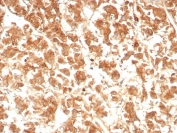 IHC staining of FFPE human adrenal gland tissue with Interleukin 18 antibody (clone IL18/4623). HIER: boil tissue sections in pH 9 10mM Tris with 1mM EDTA for 20 min and allow to cool before testing.