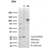SDS-PAGE analysis of purified, BSA-free recombinant TRIM29 antibody (clone TRIM29/9256R) as confirmation of integrity and purity.