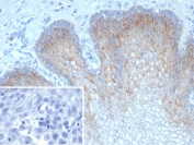 IHC staining of FFPE human esophagus tissue with recombinant TRIM29 antibody (clone TRIM29/9256R). Inset: PBS used in place of primary Ab (secondary Ab negative control). HIER: boil tissue sections in pH 9 10mM Tris with 1mM EDTA for 20 min and allow to cool before testing.