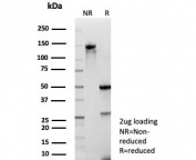 SDS-PAGE analysis of purified, BSA-free TrkB antibody (clone NTRK2/7929) as confirmation of integrity and purity.