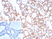IHC staining of FFPE human thyroid tissue with TrkB antibody (clone NTRK2/7929). Inset: PBS used in place of primary Ab (secondary Ab negative control). HIER: boil tissue sections in pH 9 10mM Tris with 1mM EDTA for 20 min and allow to cool before testing.