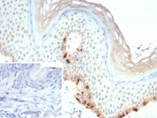 IHC staining of FFPE human skin tissue with recombinant MLANA antibody (clone rMLANA/9404). Inset: PBS used in place of primary Ab (secondary Ab negative control). HIER: boil tissue sections in pH 9 10mM Tris with 1mM EDTA for 20 min and allow to cool before testing.
