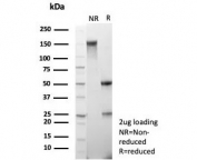 SDS-PAGE analysis of purified, BSA-free MRP8 antibody (clone ABCC11/2438) as confirmation of integrity and purity.