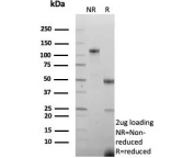 SDS-PAGE analysis of purified, BSA-free recombinant SLC45A3 antibody (clone SLC45A3/9216R) as confirmation of integrity and purity.