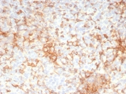 IHC staining of FFPE human adrenal gland tissue with Adipose differentiation-related protein antibody (clone rADFP/9321). HIER: boil tissue sections in pH 9 10mM Tris with 1mM EDTA for 20 min and allow to cool before testing.