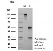 SDS-PAGE analysis of purified, BSA-free recombinant CDX2 antibody (clone rCDX2/9241) as confirmation of integrity and purity.