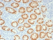 IHC staining of FFPE human colon tissue with recombinant CDX2 antibody (clone rCDX2/9241). HIER: boil tissue sections in pH 9 10mM Tris with 1mM EDTA for 20 min and allow to cool before testing.