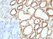 IHC staining of FFPE human kidney tissue with FGF23 antibody (clone FGF23/8939). Inset: PBS used in place of primary Ab (secondary Ab negative control). HIER: boil tissue sections in pH 9 10mM Tris with 1mM EDTA for 20 min and allow to cool before testing.