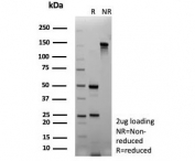 SDS-PAGE analysis of purified, BSA-free FGF23 antibody (clone FGF23/8940) as confirmation of integrity and purity.