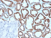 IHC staining of FFPE human kidney tissue with FGF23 antibody (clone FGF23/8940). Inset: PBS used in place of primary Ab (secondary Ab negative control). HIER: boil tissue sections in pH 9 10mM Tris with 1mM EDTA for 20 min and allow to cool before testing.