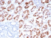 IHC staining of FFPE human kidney tissue with Fibroblast Growth Factor 23 antibody (clone FGF23/9059). Inset: PBS used in place of primary Ab (secondary Ab negative control). HIER: boil tissue sections in pH 9 10mM Tris with 1mM EDTA for 20 min and allow to cool before testing.