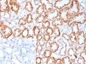 IHC staining of FFPE human kidney tissue with Fibroblast Growth Factor 23 antibody (clone FGF23/9060). Inset: PBS used in place of primary Ab (secondary Ab negative control). HIER: boil tissue sections in pH 9 10mM Tris with 1mM EDTA for 20 min and allow to cool before testing.
