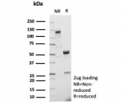 SDS-PAGE analysis of purified, BSA-free FOXP1 antibody (clone FOXP1/9381R) as confirmation of integrity and purity.