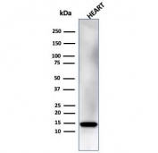 Western blot analysis of human heart tissue lysate using Resistin antibody (clone RETN/4325). Predicted molecular weight ~11 kDa.