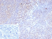 IHC staining of FFPE human tonsil tissue with recombinant LEF1 antibody (clone LEF1/9403R). Strong nuclear staining of non-germinal center of cells observed. Inset: PBS used in place of primary Ab (secondary Ab negative control). HIER: boil tissue sections in pH 9 10mM Tris with 1mM EDTA for 20 min and allow to cool before testing.