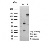 SDS-PAGE analysis of purified, BSA-free recombinant xCT antibody (clone SLC7A11/9136R) as confirmation of integrity and purity.