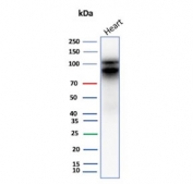 Western blot testing of human heart tissue lysate with Cadherin 2 antibody (clone CDH2/9489). Predicted molecular weight ~100 kDa (unmodified), 125-140 kDa (modified).