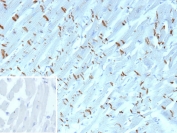 IHC staining of FFPE human heart tissue with Cadherin 2 antibody (clone CDH2/9489). Inset: PBS used in place of primary Ab (secondary Ab negative control). HIER: boil tissue sections in pH 9 10mM Tris with 1mM EDTA for 20 min and allow to cool before testing.