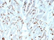 IHC staining of FFPE human heart tissue with Cadherin 2 antibody (clone CDH2/9490). HIER: boil tissue sections in pH 9 10mM Tris with 1mM EDTA for 20 min and allow to cool before testing.