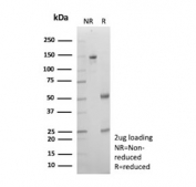 SDS-PAGE analysis of purified, BSA-free Cadherin 2 antibody (clone CDH2/9491) as confirmation of integrity and purity.