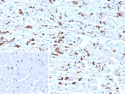 IHC staining of FFPE human heart tissue with CDH2 antibody (clone CDH2/9492). Inset: PBS used in place of primary Ab (secondary Ab negative control). HIER: boil tissue sections in pH 9 10mM Tris with 1mM EDTA for 20 min and allow to cool before testing.