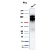 Western blot testing of human heart tissue lysate with Cadherin 2 antibody (clone CDH2/9494). Predicted molecular weight ~100 kDa (unmodified), 125-140 kDa (modified).