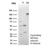 SDS-PAGE analysis of purified, BSA-free Cadherin 17 antibody (clone CDH17/2612) as confirmation of integrity and purity.