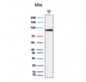 Western blot testing of human small intestine tissue lysate with Cadherin 17 antibody (clone CDH17/2612). Predicted molecular weight ~92 kDa but may be observed at higher molecular weights due to glycosylation.