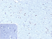 IHC staining of FFPE human brain tissue with Oligodendrocyte transcription factor 2 antibody (clone OLIG2/9995R). Inset: PBS used in place of primary Ab (secondary Ab negative control). HIER: boil tissue sections in pH 9 10mM Tris with 1mM EDTA for 20 min and allow to cool before testing.