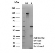 SDS-PAGE analysis of purified, BSA-free Mesothelin antibody (clone MSLN/3383) as confirmation of integrity and purity.