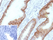 IHC staining of FFPE human prostate tissue with MOAT-B antibody (clone ABCC4/9178). Inset: PBS used in place of primary Ab (secondary Ab negative control). HIER: boil tissue sections in pH 9 10mM Tris with 1mM EDTA for 20 min and allow to cool before testing.