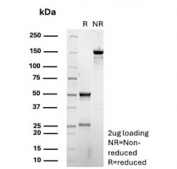 SDS-PAGE analysis of purified, BSA-free recombinant CDKN1B antibody (clone rCDKN1B/13245) as confirmation of integrity and purity.