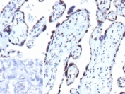 IHC staining of FFPE human placental tissue with recombinant CDKN1B antibody (clone PASE/4LJ). Inset: PBS used in place of primary Ab (secondary Ab negative control). HIER: boil tissue sections in pH 9 10mM Tris with 1mM EDTA for 20 min and allow to cool before testing.