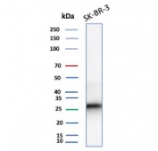 Western blot testing of human SK-BR-3 cell lysate with recombinant CDKN1B antibody (clone rCDKN1B/13245). Commonly observed at ~27 kDa.