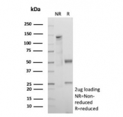 SDS-PAGE analysis of purified, BSA-free Caudal type homeobox transcription factor 2 antibody (clone CDX2/9338) as confirmation of integrity and purity.