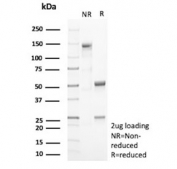 SDS-PAGE analysis of purified, BSA-free Periostin antibody (clone POSTN/4095) as confirmation of integrity and purity.