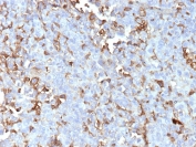 IHC staining of FFPE human adrenal gland tissue with Periostin antibody (clone POSTN/4095). HIER: boil tissue sections in pH 9 10mM Tris with 1mM EDTA for 20 min and allow to cool before testing.