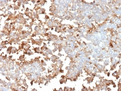 IHC staining of FFPE human adrenal gland tissue with Periostin antibody (clone POSTN/4096). HIER: boil tissue sections in pH 9 10mM Tris with 1mM EDTA for 20 min and allow to cool before testing.