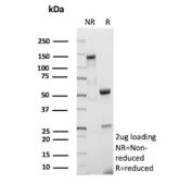 SDS-PAGE analysis of purified, BSA-free Cofilin 2 antibody (clone CFL2/9963) as confirmation of integrity and purity.