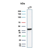 Western blot testing of human Y79 cell lysate with Creatine kinase B-type antibody (clone CKBB/6636). Predicted molecular weight ~43 kDa.