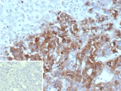 IHC staining of FFPE human adrenal gland tissue with Clusterin antibody (clone CLU/4736). Inset: PBS used in place of primary Ab (secondary Ab negative control). HIER: boil tissue sections in pH 9 10mM Tris with 1mM EDTA for 20 min and allow to cool before testing.