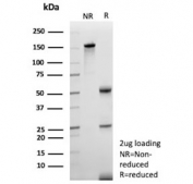 SDS-PAGE analysis of purified, BSA-free Apolipoprotein J antibody (clone CLU/4737) as confirmation of integrity and purity.