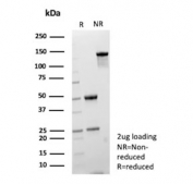 SDS-PAGE analysis of purified, BSA-free Carbamoyl phosphate synthetase 1 antibody (clone CPS1/9865) as confirmation of integrity and purity.