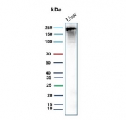 Western blot testing of human liver tissue lysate with CPS1 antibody (clone CPS1/9868). Predicted molecular weight ~165 kDa but may be observed at higher molecular weights due to glycosylation.