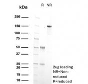 SDS-PAGE analysis of purified, BSA-free CYP2C9 antibody (clone CYP2C9/13121) as confirmation of integrity and purity.