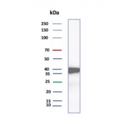 Western blot testing of human A549 cell lysate with Dihydrodiol dehydrogenase 1 antibody (clone AKR1C1/9318). Predicted molecular weight ~37 kDa.