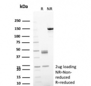 SDS-PAGE analysis of purified, BSA-free Dihydrodiol dehydrogenase 1 antibody (clone AKR1C1/9318) as confirmation of integrity and purity.