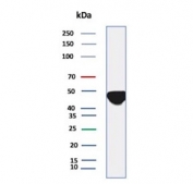 Western blot testing of human A431 cell lysate with Tissue Factor antibody (clone CD142/9195). Expected molecular weight: 33-50 kDa depending on glycosylation level.