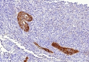 IHC staining of FFPE human lung tissue with Tissue Factor antibody (clone CD142/9196). HIER: boil tissue sections in pH 9 10mM Tris with 1mM EDTA for 20 min and allow to cool before testing.