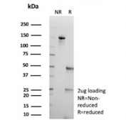 SDS-PAGE analysis of purified, BSA-free F3 antibody (clone CD142/9196) as confirmation of integrity and purity.